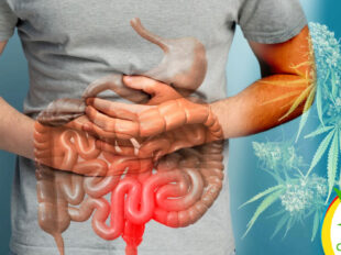 CBD contra la Inflamación Intestinal