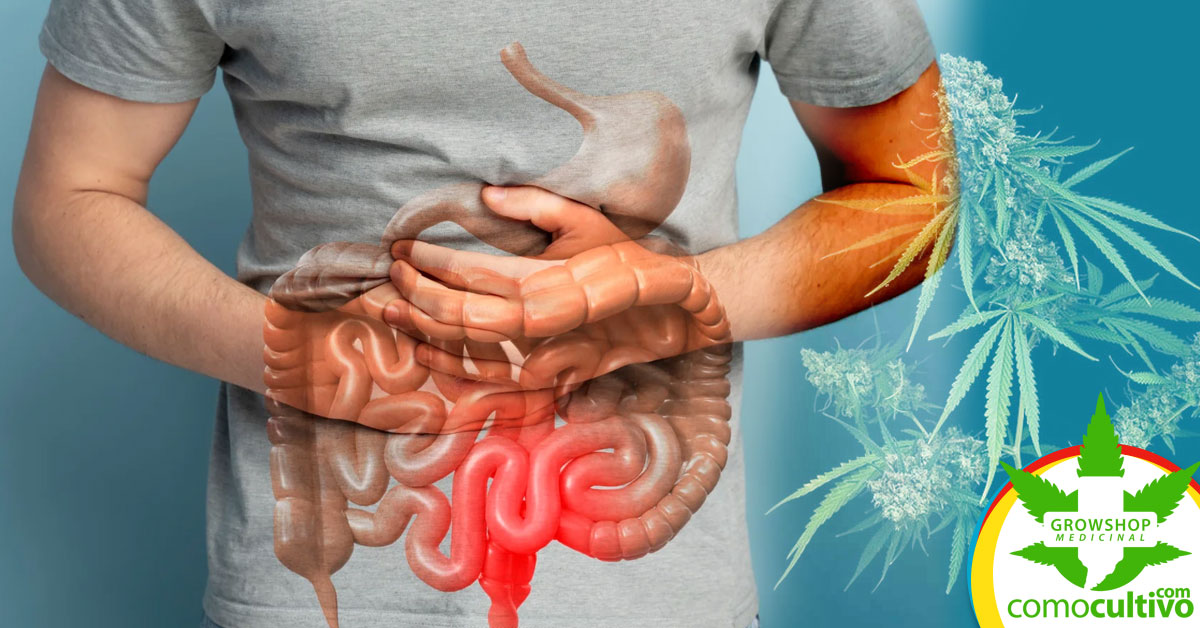 CBD contra la Inflamación Intestinal